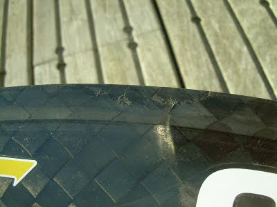 Fait mal les reins à gauche écoeure par derrière